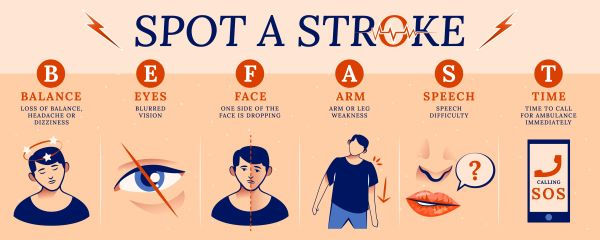 Types of Stroke: Ischemic vs Hemorrhagic vs TIA Explained